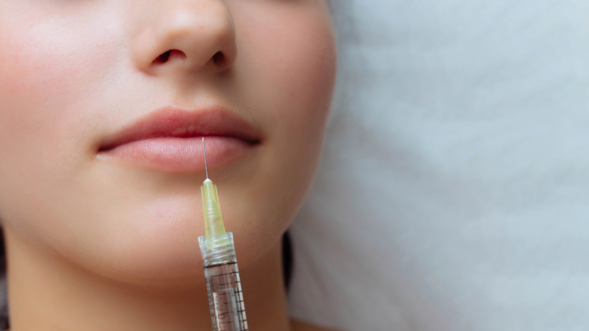 Dermal Fillers