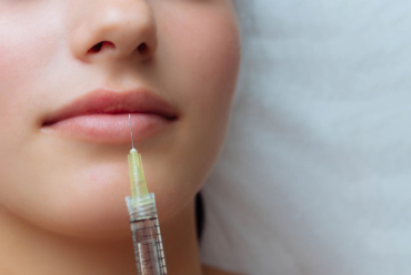 Dermal Fillers