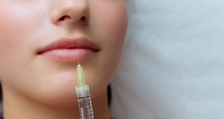 Dermal Fillers