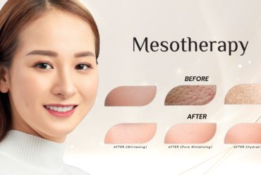 Mesotherapy