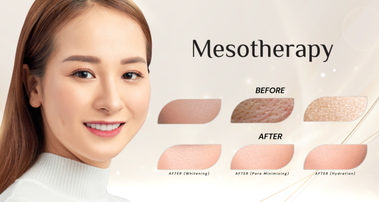 Mesotherapy