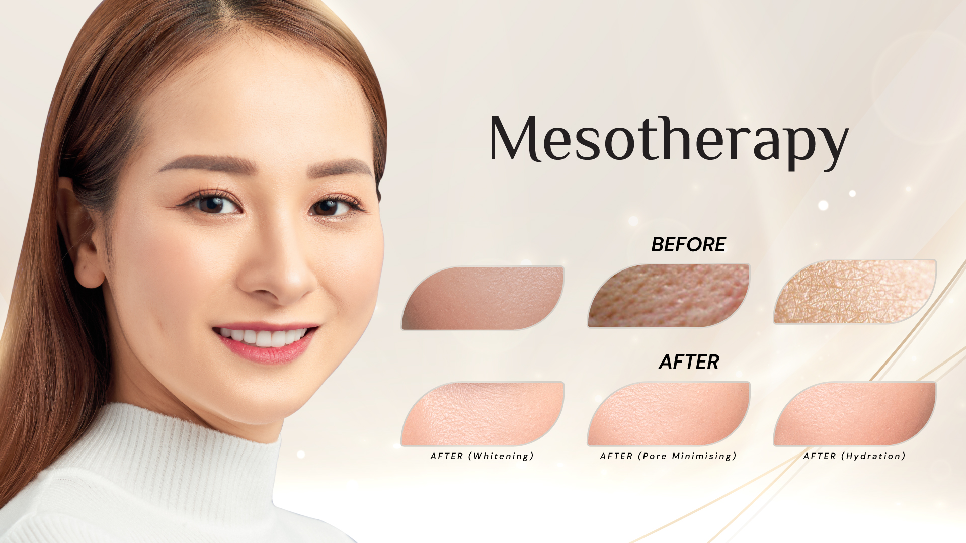 Renew Your Skin and Hair with Mesotherapy Treatment in Malaysia