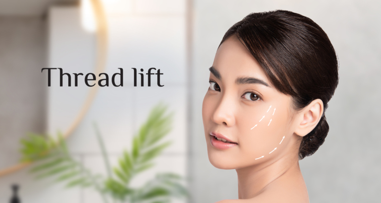 Thread lift